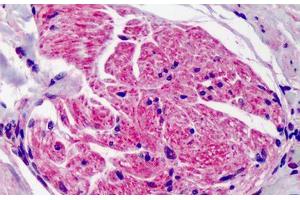 Anti-SUMO2/SUMO3 antibody IHC of human adrenal.
