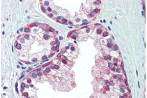 Human Prostate (formalin-fixed, paraffin-embedded) stained with NRF1 antibody ABIN462197 followed by biotinylated goat anti-rabbit IgG secondary antibody ABIN481713, alkaline phosphatase-streptavidin and chromogen.
