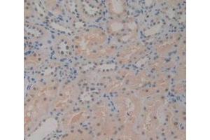 Detection of CD161 in Human Kidney Tissue using Polyclonal Antibody to Cluster Of Differentiation 161 (CD161)