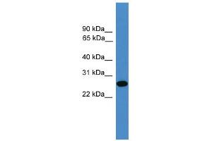 WB Suggested Anti-TIMP2 Antibody Titration: 0. (TIMP2 anticorps  (N-Term))