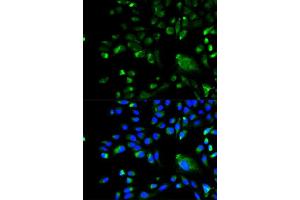 Immunofluorescence analysis of A549 cell using BCL10 antibody. (BCL10 anticorps  (AA 1-233))