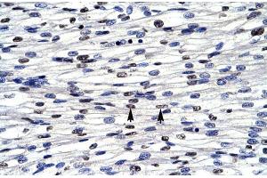 Human Heart; CGI-143 antibody - N-terminal region in Human Heart cells using Immunohistochemistry (BOLA1 anticorps  (N-Term))