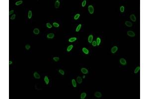 Immunofluorescent analysis of Hela cells (sodium butyrate, 30 mM, 4h) using ABIN7139148 at dilution of 1:100 and Alexa Fluor 488-congugated AffiniPure Goat Anti-Rabbit IgG(H+L) (H2AFZ anticorps  (H2A.ZK11ac))