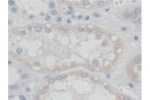 Detection of SGSH in Human Kidney Tissue using Polyclonal Antibody to N-Sulfoglucosamine Sulfohydrolase (SGSH)