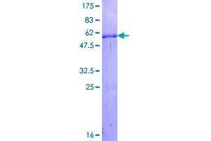 Image no. 1 for Goosecoid Homeobox (GSC) (AA 1-257) protein (GST tag) (ABIN1306020)