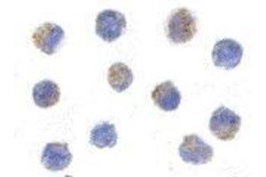 Immunocytochemistry of AIF in K562 cells with AP30031PU-N AIF antibody at 5 μg/ml. (AIF anticorps  (C-Term))