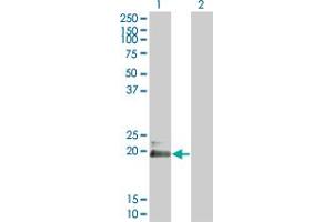 Western Blot analysis of HAND2 expression in transfected 293T cell line by HAND2 monoclonal antibody (M03), clone 3E3. (HAND2 anticorps  (AA 135-216))