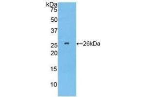 Detection of Recombinant TPPP, Human using Polyclonal Antibody to Tubulin Polymerization Promoting Protein (TPPP) (Tppp anticorps  (AA 8-210))