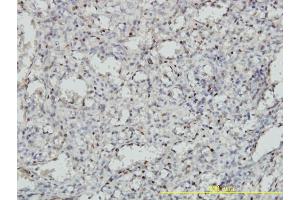 Immunoperoxidase of monoclonal antibody to MEIS2 on formalin-fixed paraffin-embedded human spleen tissue. (MEIS2 anticorps  (AA 1-381))