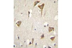 Formalin fixed and paraffin embedded human brain tissue stained with MYO6 Antibody (C-term) followed by peroxidase conjugation of the secondary antibody and DAB staining.