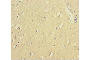 Immunohistochemistry of paraffin-embedded human brain tissue using ABIN7152719 at dilution of 1:100 (FTL anticorps  (AA 2-175))