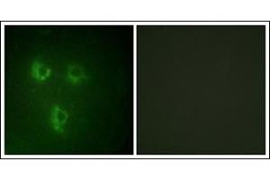 Immunofluorescence analysis of HuvEc cells, using TMEPA Antibody. (PMEPA1 anticorps)