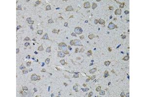Immunohistochemistry of paraffin-embedded Mouse brain using IL1A Polyclonal Antibody at dilution of 1:100 (40x lens). (IL1A anticorps)