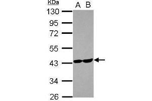 WB Image Sample (30 ug of whole cell lysate) A: U87-MG B: MCF-7 10% SDS PAGE antibody diluted at 1:1000 (ALDOC anticorps)