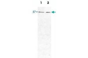 Western Blot analysis of HIP1R protein in HeLa cell (Lane 1) and rat brain (Lane 2) lysates, using HIP1R monoclonal antibody, clone 1E5  at 1 : 1000 dilution. (HIP1R anticorps)