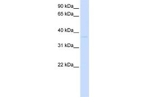WB Suggested Anti-GDAP1L1 Antibody Titration:  0. (GDAP1L1 anticorps  (N-Term))