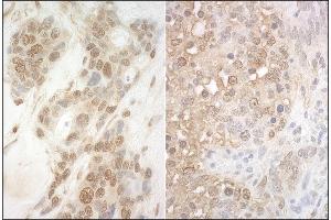 anti-Anaphase Promoting Complex Subunit 7 (ANAPC7) (AA 75-125) antibody