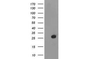 Western Blotting (WB) image for anti-Deoxythymidylate Kinase (Thymidylate Kinase) (DTYMK) antibody (ABIN1497922) (DTYMK anticorps)
