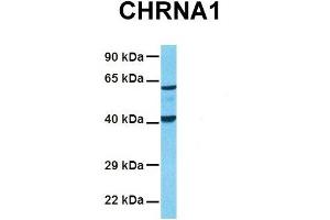 Host:  Rabbit  Target Name:  CHRNA1  Sample Tissue:  Human Fetal Lung  Antibody Dilution:  1. (CHRNA1 anticorps  (C-Term))