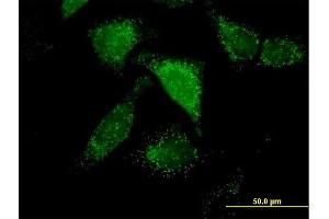 Immunofluorescence of purified MaxPab antibody to ACOX1 on HeLa cell.