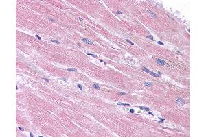 Anti-PPAPDC3 antibody IHC of human heart.