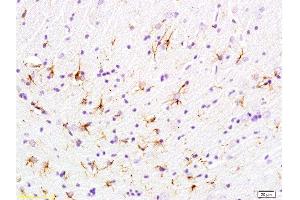 Formalin-fixed and paraffin embedded rat brain labeled with Anti-phospho-GFAP Polyclonal Antibody, Unconjugated  at 1:200 followed by conjugation to the secondary antibody and DAB staining (GFAP anticorps  (pSer8))