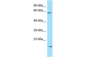 WB Suggested Anti-SOWAHC Antibody Titration: 1. (ANKRD57 anticorps  (C-Term))