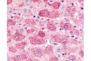 Anti-MINK1 / MINK antibody IHC of human liver.