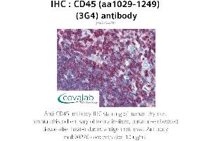 Image no. 2 for anti-Protein tyrosine Phosphatase, Receptor Type, C (PTPRC) (AA 1029-1249) antibody (ABIN1723202)