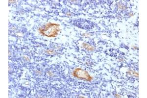 IHC testing of FFPE human tonsil with recombinant vWF antibody (clone VWF/1859R). (Recombinant VWF anticorps  (AA 1815-1939))
