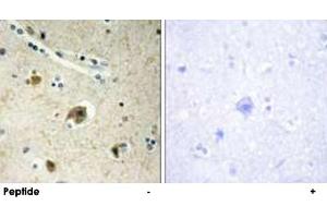 Immunohistochemistry analysis of paraffin-embedded human brain tissue using COL4A4 polyclonal antibody . (Col4a4 anticorps)