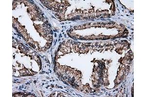 Immunohistochemical staining of paraffin-embedded liver tissue using anti-FAHD2A mouse monoclonal antibody. (FAHD2A anticorps)