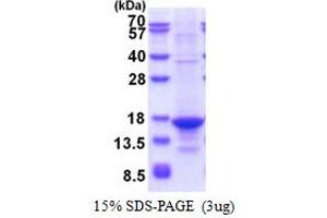 SDS-PAGE (SDS) image for Tumor Necrosis Factor (Ligand) Superfamily, Member 13 (TNFSF13) (AA 105-247) protein (T7 tag) (ABIN5853601)