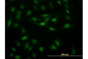 Immunofluorescence of monoclonal antibody to STAT5B on HeLa cell.