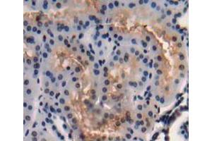 Used in DAB staining on fromalin fixed paraffin- embedded Kidney tissue