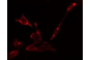ABIN6275123 staining Hela cells by IF/ICC. (EIF5B anticorps  (C-Term))