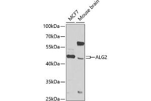 Western blot analysis of extracts of various cell lines, using  antibody (ABIN6131238, ABIN6136792, ABIN6136793 and ABIN6223816) at 1:1000 dilution. (ALG2 anticorps  (AA 197-416))