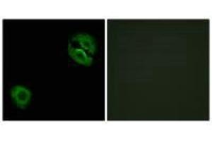 Immunofluorescence analysis of A549 cells, using Collagen XIX α1 antibody.