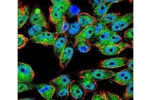 Confocal immunofluorescent analysis of TP53 antibody with A2058 cells followed by Alexa Fluor 488-conjugated goat anti-rabbit lgG (green).