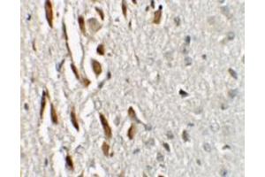 Immunohistochemistry of TSHZ3 in mouse brain tissue with TSHZ3 / ZNF537 Antibody at 2. (TSHZ3 anticorps  (N-Term))