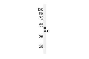 CTGF Antibody (Center) (ABIN392205 and ABIN2841905) western blot analysis in mouse bladder tissue lysates (35 μg/lane). (CTGF anticorps  (AA 134-159))