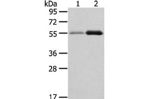 Western Blot analysis of Human normal stomach and thyroid cancer tissue using XKR3 Polyclonal Antibody at dilution of 1/330 (XKR3 anticorps)
