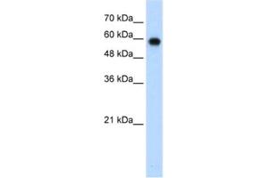 Western Blotting (WB) image for anti-SWI/SNF Related, Matrix Associated, Actin Dependent Regulator of Chromatin, Subfamily D, Member 2 (SMARCD2) antibody (ABIN2461675) (SMARCD2 anticorps)