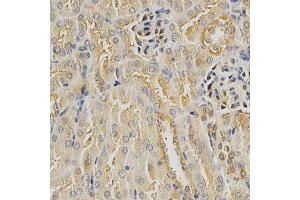 Immunohistochemistry of paraffin-embedded mouse kidney using HDAC6 antibody (ABIN5997884) at dilution of 1/100 (40x lens). (HDAC6 anticorps)