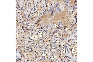 IHC analysis of STAG2 using anti-STAG2 antibody (ABIN7602420).