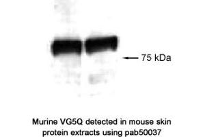Image no. 1 for anti-Angiogenic Factor with G Patch and FHA Domains 1 (AGGF1) (AA 300-400) antibody (ABIN363346)