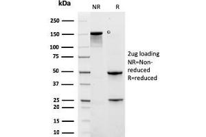 SDS-PAGE Analysis Purified KRT6A Recombinant Mouse Monoclonal Antibody (rKRT6A/2100). (Recombinant KRT6A anticorps)