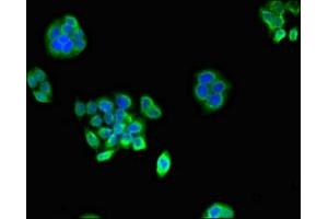 Immunofluorescent analysis of PC-3 cells using ABIN7164944 at dilution of 1:100 and Alexa Fluor 488-congugated AffiniPure Goat Anti-Rabbit IgG(H+L)