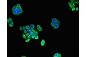 Immunofluorescent analysis of PC-3 cells using ABIN7164944 at dilution of 1:100 and Alexa Fluor 488-congugated AffiniPure Goat Anti-Rabbit IgG(H+L) (PSMA1 anticorps  (AA 163-263))