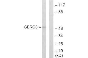 Western blot analysis of extracts from 293 cells, using SERC3 antibody. (SERINC3 anticorps  (C-Term))